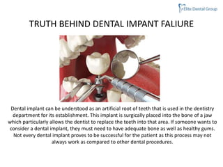 TRUTH BEHIND DENTAL IMPANT FALIURE
Dental implant can be understood as an artificial root of teeth that is used in the dentistry
department for its establishment. This implant is surgically placed into the bone of a jaw
which particularly allows the dentist to replace the teeth into that area. If someone wants to
consider a dental implant, they must need to have adequate bone as well as healthy gums.
Not every dental implant proves to be successful for the patient as this process may not
always work as compared to other dental procedures.
 