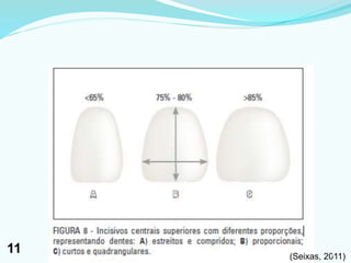 (Seixas, 2011)111
11
 