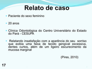 Relato de caso
 Paciente do sexo feminino
 20 anos
 Clínica Odontológica do Centro Universitário do Estado
do Pará - CESUPA
 Relatando insatisfação com a aparência do seu sorriso
que exibia uma faixa de tecido gengival excessiva,
dentes curtos, além de um ligeiro escurecimento da
mucosa marginal
(Pires, 2010)
171
17
 