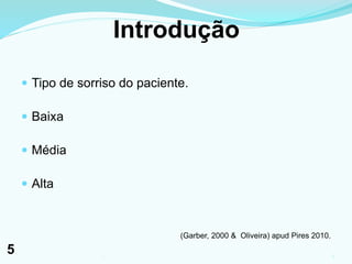 Introdução
 Tipo de sorriso do paciente.
 Baixa
 Média
 Alta
(Garber, 2000 & Oliveira) apud Pires 2010.
51
5
 