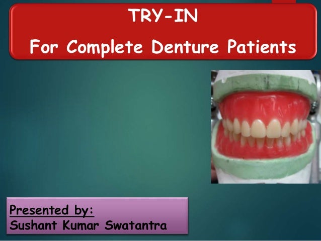 Try In Of Complete Dentures - 