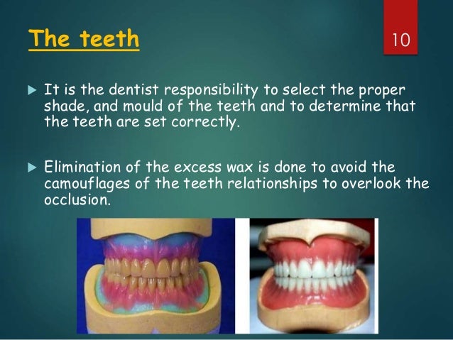 Denture Teeth Size Chart