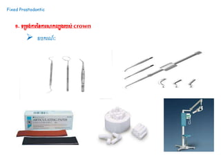 Fixed Prostodontic
១.ទ្យស្រម្ង់ការននការសាកលបងរបស់crown
 ឧបករណ៍ៈ
 