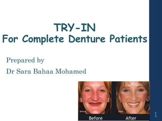 TRY-IN
For Complete Denture Patients
Prepared by
Dr Sara Bahaa Mohamed
1
 