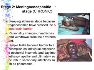 •Stage 2: Meningoencephaltic
stage (CHRONIC)
– Sleeping sickness stage because
trypanosomes have crossed the b
lood-brain barrier
– Personality changes, headaches
and withdrawal from the environm
ent.
– Simple tasks become harder to a
ccomplish as individual experienc
e nocturnal insomnia and daytime
lethargy, apathy and ultimately su
ccumb to secondary infections su
ch as pneumonia.
 