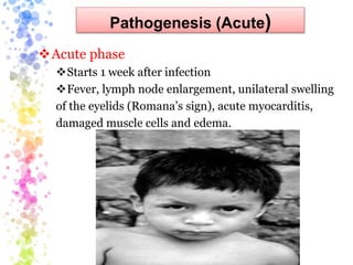 Pathogenesis (Acute)
Acute phase
Starts 1 week after infection
Fever, lymph node enlargement, unilateral swelling
of the eyelids (Romana’s sign), acute myocarditis,
damaged muscle cells and edema.
 
