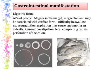 Gastrointestinal manifestation
Digestive form:
10% of people. Megaoesophagus 3%, megacolon and may
be associated with cardiac form. Difficulty in swallowi
ng, regurgitation, aspiration may cause pneumonia an
d death. Chronic constipation, fecal compacting causes
perforation of the colon.
 