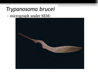 Trypanosoma brucei
• micrograph under SEM:
 