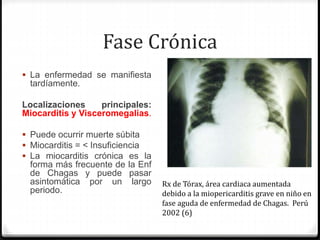 Fase Crónica
 La enfermedad se manifiesta
tardíamente.
Localizaciones principales:
Miocarditis y Visceromegalias.
 Puede ocurrir muerte súbita
 Miocarditis = < Insuficiencia
 La miocarditis crónica es la
forma más frecuente de la Enf
de Chagas y puede pasar
asintomática por un largo
periodo.
Rx de Tórax, área cardiaca aumentada
debido a la miopericarditis grave en niño en
fase aguda de enfermedad de Chagas. Perú
2002 (6)
 