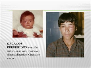 ORGANOS
PREFERIDOS: corazón,
sistema nervioso, músculo y
sistema digestivo. Circula en
sangre.
 