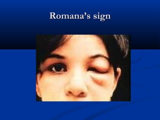 Romana’s signRomana’s sign
 