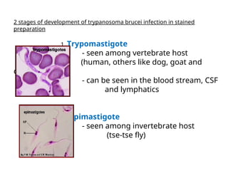 2 stages of development of trypanosoma brucei infection in stained
preparation
1. Trypomastigote
- seen among vertebrate host
(human, others like dog, goat and
cattle)
- can be seen in the blood stream, CSF
and lymphatics
2. Epimastigote
- seen among invertebrate host
(tse-tse fly)
 