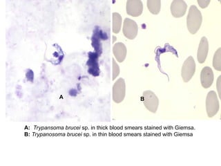 A: Trypansoma brucei sp. in thick blood smears stained with Giemsa.
B: Trypanosoma brucei sp. in thin blood smears stained with Giemsa
A B
 