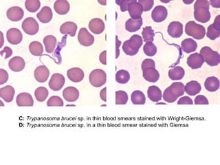 C: Trypanosoma brucei sp. in thin blood smears stained with Wright-Giemsa.
D: Trypanosoma brucei sp. in a thin blood smear stained with Giemsa
 