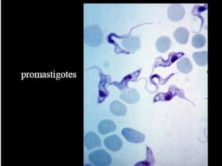 Understanding Trypanosomiasis and causes