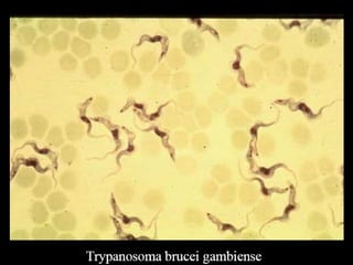 Understanding Trypanosomiasis and causes
