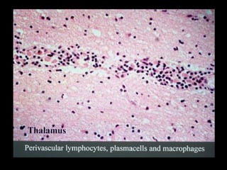 Understanding Trypanosomiasis and causes