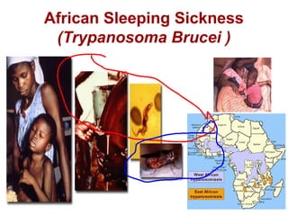 African Sleeping Sickness
(Trypanosoma Brucei )
 