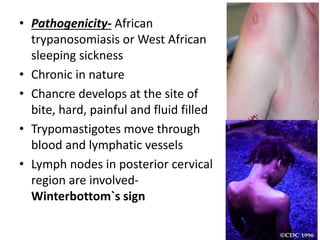Winterbutton Sign Trypanosomiasis .pptx