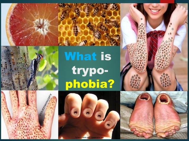 Trypophobia Ppt