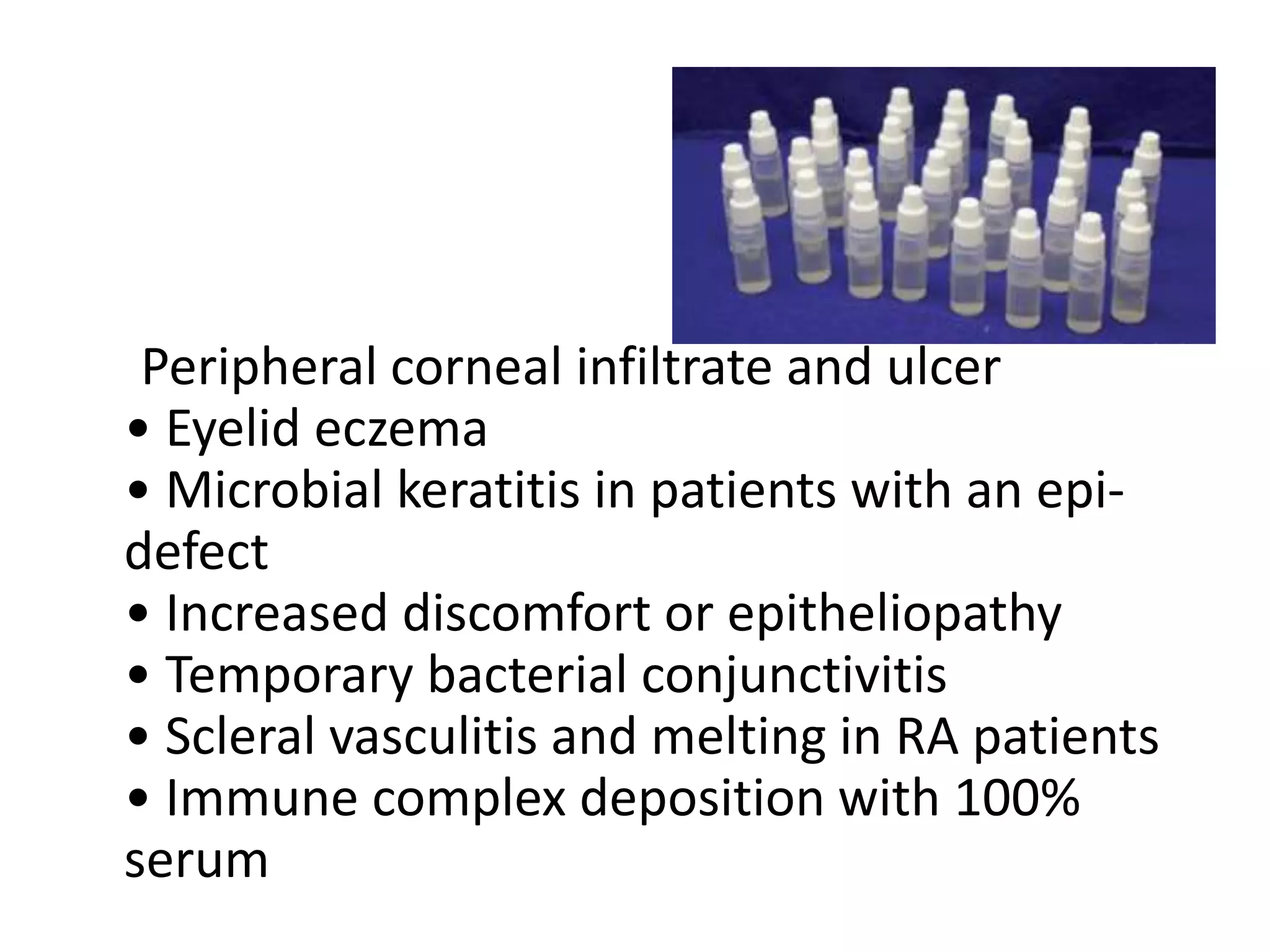 Peripheral corneal infiltrate and ulcer
• Eyelid eczema
• Microbial keratitis in patients with an epi-
defect
• Increased discomfort or epitheliopathy
• Temporary bacterial conjunctivitis
• Scleral vasculitis and melting in RA patients
• Immune complex deposition with 100%
serum
 