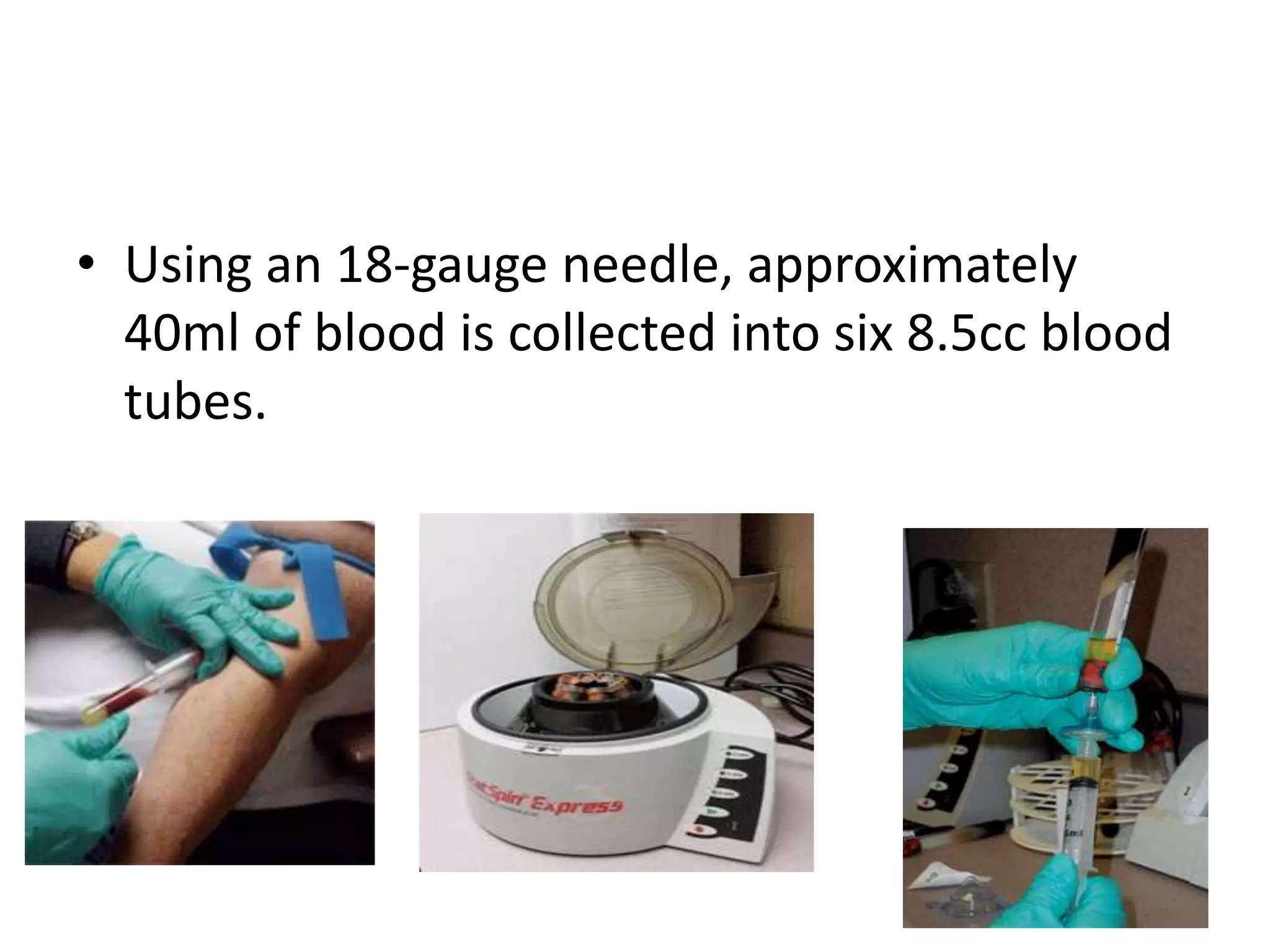 • Using an 18-gauge needle, approximately
40ml of blood is collected into six 8.5cc blood
tubes.
 