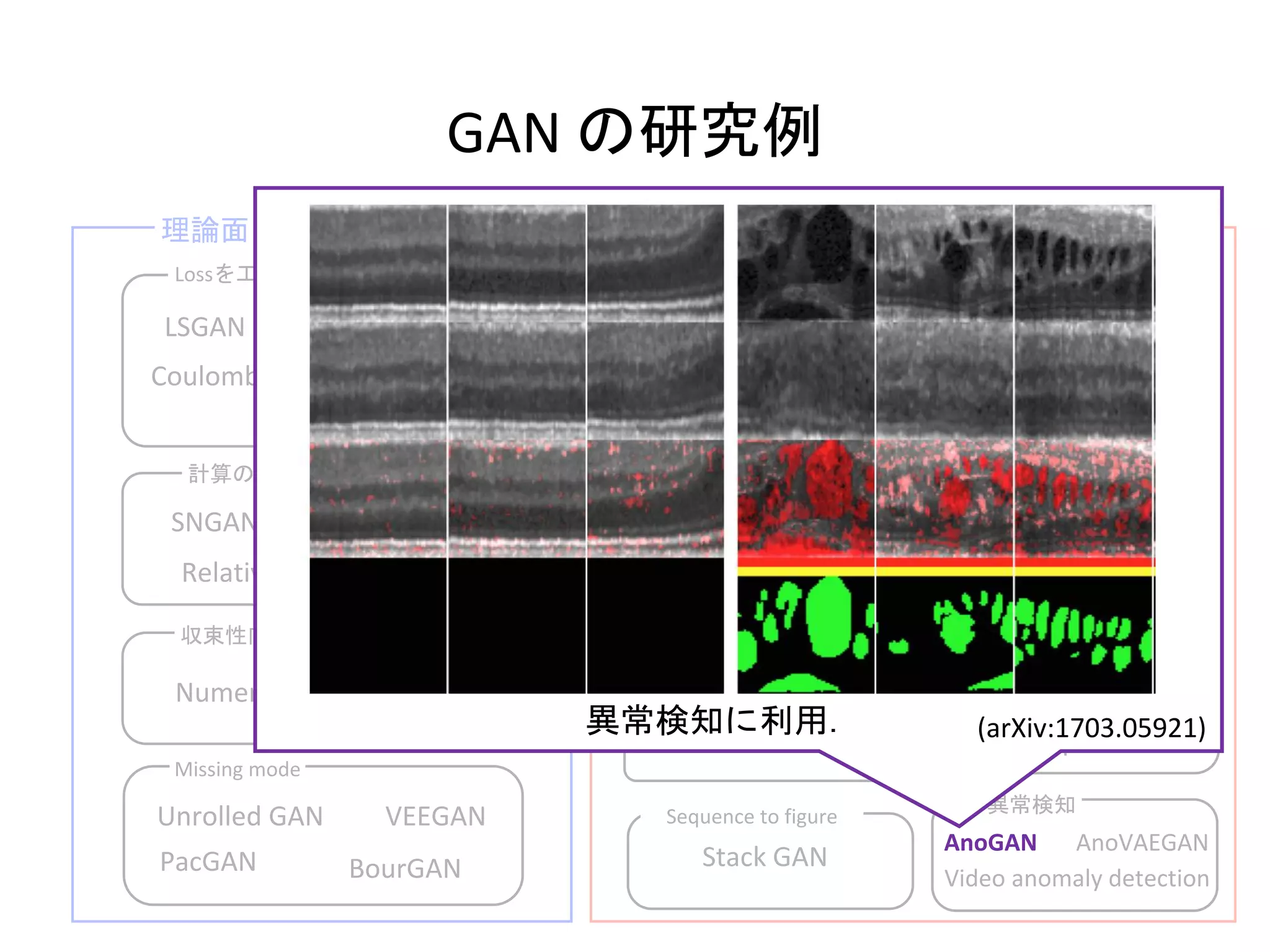 ESRGAN
CycleGAN
BigGAN
DCGAN
GAN の研究例
理論面 応用例
Lossを工夫
収束性向上
画像生成
domain変換
異常検知Sequence to figure
Progressive GAN
DiscoGAN
Stack GAN
Video anomaly detection
(V)AEとの合わせ技
AAE
VAEGAN
3D
3DRecGAN
Coulomb GAN
WGAN
WGAN-GP
SNGAN TTUR
LSGAN
Image Compression
Relativistic GAN
Numeric of GANs
AnoVAEGAN
Domain Adaptation
ADDA
DIRT-T
CycADA
Missing mode
Unrolled GAN
PacGAN
VEEGAN
BourGAN
Super resolution
SRGAN
Style-Based GAN
disentanglement
InfoGAN URDF
計算の安定性向上
異常検知に利用．
AnoGAN
(arXiv:1703.05921)
 