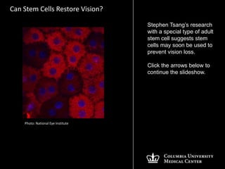Can Stem Cells Restore Vision?

                                    Stephen Tsang’s research
                                    with a special type of adult
                                    stem cell suggests stem
                                    cells may soon be used to
                                    prevent vision loss.

                                    Click the arrows below to
                                    continue the slideshow.




    Photo: National Eye Institute
 