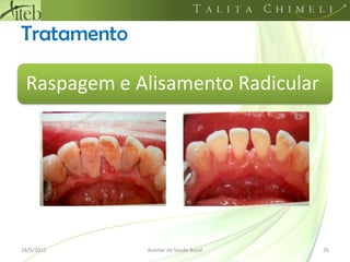 Tratamento18/09/201126Auxiliar de Saúde Bucal