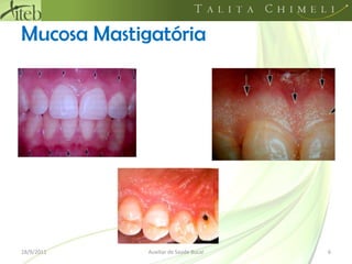 Mucosa Mastigatória18/09/20116Auxiliar de Saúde Bucal
