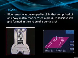 T SCAN I
• Blue sensor was developed in 1984 that comprised of
an epoxy matrix that encased a pressure sensitive ink
grid formed in the shape of a dental arch
 