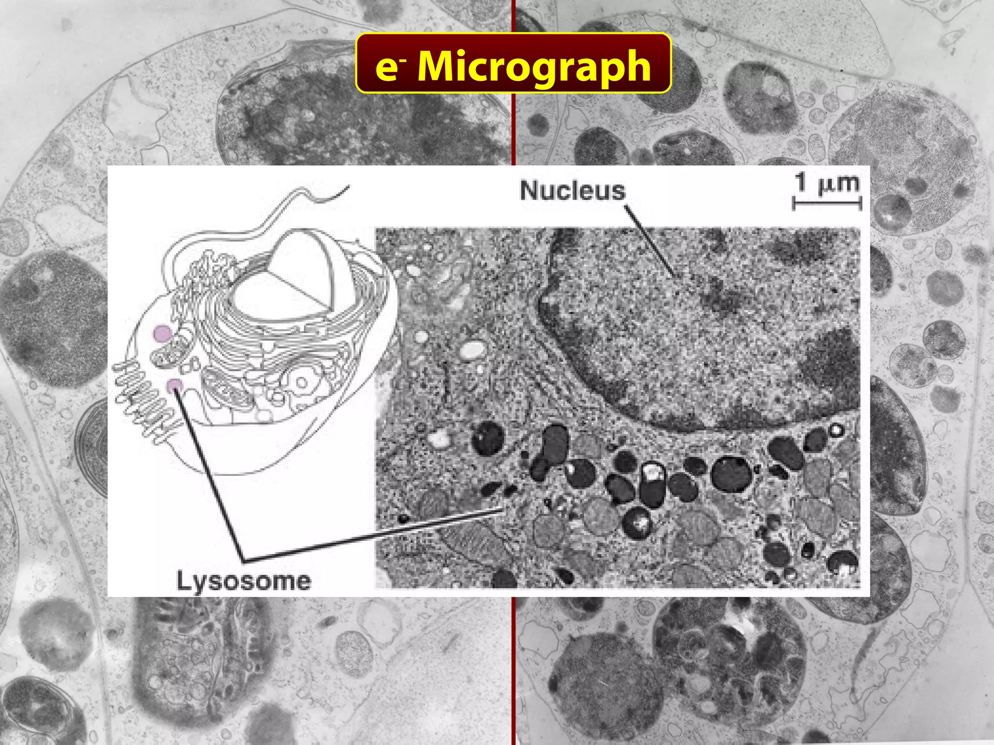 About the Lysosome e -  Micrograph 