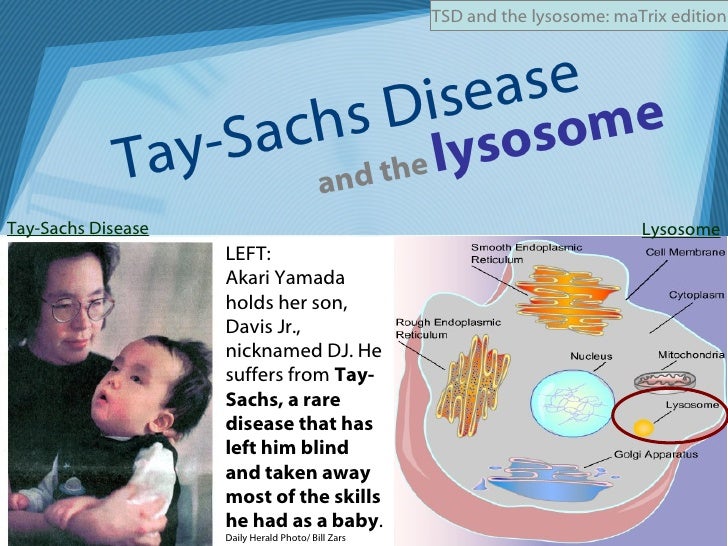TSD and the lysosome (maTrix edition)