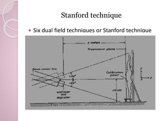 Stanford technique 
 Six dual field techniques or Stanford technique 
 