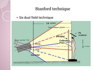 Stanford technique 
 Six dual field technique 
 