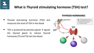 Thyroid Stimulating Hormone Test | ODP