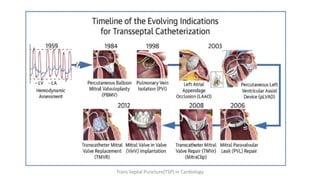 Trans Septal Puncture(TSP) in Cardiology
 