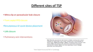 Different sites of TSP
• Mitra clip or paravalvular leak closure
• Trans septal PFO closure
•Percutaneous LV assist device placement
• LAA closure
• Pulmonary vein interventions
Trans Septal Puncture(TSP) in Cardiology
 