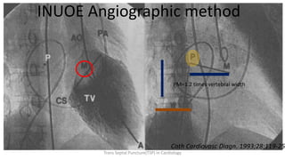 INUOE Angiographic method
Cath Cardiovasc Diagn. 1993;28:119-25
PM=1.2 times vertebral width
Trans Septal Puncture(TSP) in Cardiology
 