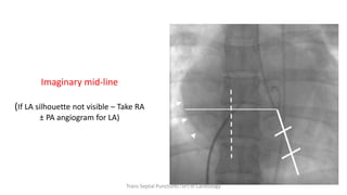 Imaginary mid-line
(If LA silhouette not visible – Take RA
± PA angiogram for LA)
Trans Septal Puncture(TSP) in Cardiology
 