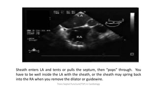 Sheath enters LA and tents or pulls the septum, then “pops” through. You
have to be well inside the LA with the sheath, or the sheath may spring back
into the RA when you remove the dilator or guidewire.
Trans Septal Puncture(TSP) in Cardiology
 