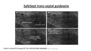 SafeSept trans-septal guidewire
World J Cardiol 2015 August 26; 7(8): 499-503 ISSN 1949-8462
Trans Septal Puncture(TSP) in Cardiology
 