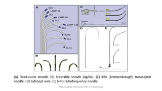 (A) Fixed-curve sheath. (B) Steerable sheath (Agillis). (C) BRK (Brockenbrough) transseptal
needle. (D) SafeSept wire. (E) NRG radiofrequency needle.
Trans Septal Puncture(TSP) in Cardiology
 