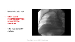 • Overall Mortality <1%
• MUST LEARN
PERICARDIOCENTASIS
BEFORE SEPTAL
PUNCTURE
• Echo must be readily
available
Trans Septal Puncture(TSP) in Cardiology
 