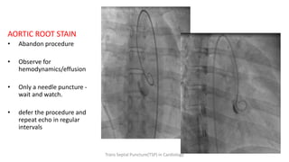 AORTIC ROOT STAIN
• Abandon procedure
• Observe for
hemodynamics/effusion
• Only a needle puncture -
wait and watch.
• defer the procedure and
repeat echo in regular
intervals
Trans Septal Puncture(TSP) in Cardiology
 