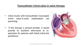 Transcatheter mitral valve-in-valve therapy
• Initial results with transcatheter transseptal
mitral valve-in-valve implantation are
promising.
• If this therapy is proved durable, it would
provide an excellent alternative to re-
operation for patients with failed mitral bio
prostheses.
Trans Septal Puncture(TSP) in Cardiology
 