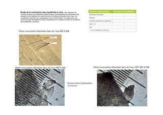 Etude de la contraction des myofibrille in vitro. Des fragments de
muscles de lapin sont prélevés et traités de façon à désorganiser les membranes des
cellules et des organites et à extraire toutes les molécules solubles dans l’eau. Les
myofibrilles conservent leur organisation et leur fonctionnalité. On plonge dans une
solution ionique semblable au milieu intracellulaire et on observe si elles se contractent
dans différentes conditions	
  
Fibres	
  musculaires	
  dilacérées	
  dans	
  de	
  l’eau	
  MO	
  X	
  400	
  
Fibres	
  musculaires	
  dilacérées	
  dans	
  de	
  l’eau	
  MO	
  X	
  500	
   Fibres	
  musculaires	
  dilacérées	
  dans	
  de	
  l’eau	
  +ATP	
  MO	
  X	
  500	
  
Distance	
  entre	
  2	
  gradua)ons	
  :	
  
	
  10	
  microns	
  	
  
 