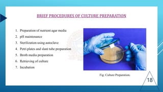 18
1. Preparation of nutrient agar media
2. pH maintenance
3. Sterilization using autoclave
4. Petri plates and slant tube preparation
5. Broth media preparation
6. Retrieving of culture
7. Incubation
BRIEF PROCEDURES OF CULTURE PREPARATION
Fig: Culture Preparation)
 