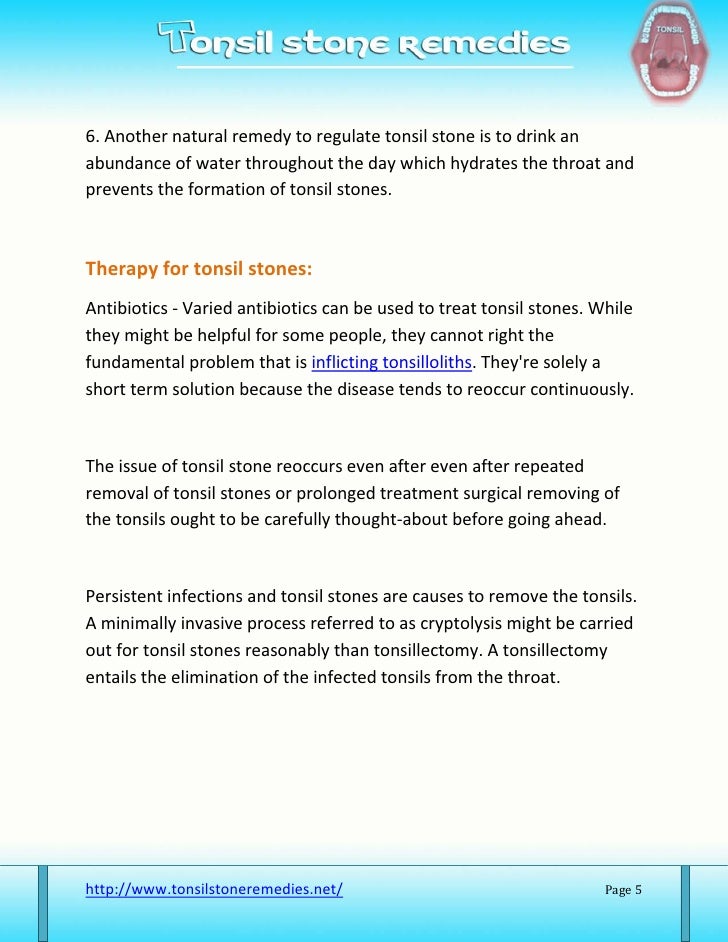 for stones solution tonsil Tonsil and preventive effective treatments: stone healing