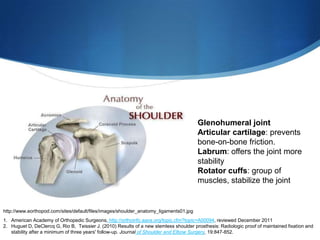 Glenohumeral joint
                                                                                        Articular cartilage: prevents
                                                                                        bone-on-bone friction.
                                                                                        Labrum: offers the joint more
                                                                                        stability
                                                                                        Rotator cuffs: group of
                                                                                        muscles, stabilize the joint


http://www.eorthopod.com/sites/default/files/images/shoulder_anatomy_ligaments01.jpg
1. American Academy of Orthopedic Surgeons, http://orthoinfo.aaos.org/topic.cfm?topic=A00094, reviewed December 2011
2. Huguet D, DeClercq G, Rio B, Teissier J. (2010) Results of a new stemless shoulder prosthesis: Radiologic proof of maintained fixation and
   stability after a minimum of three years' follow-up. Journal of Shoulder and Elbow Surgery, 19:847-852.
 